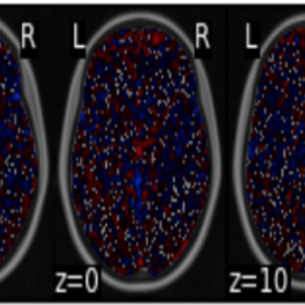 fMRI brain-activation slices from the meme-sharing prediction study